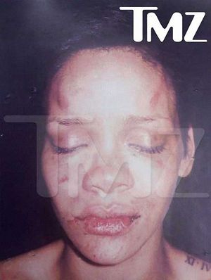 Rihanna beating