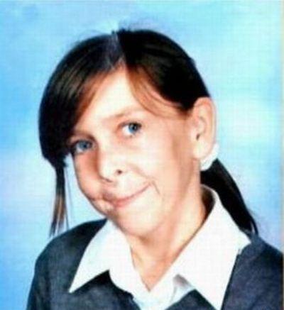 Шок: 13-летняя девочка Зара Хартшорн (Zara Hartshorn) получила в наследство... старость (ФОТО)