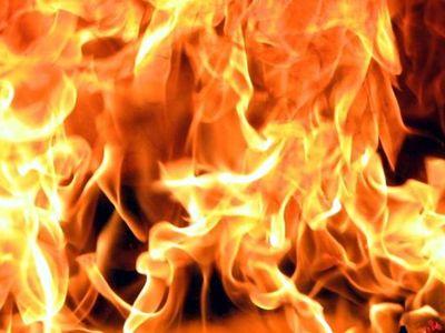В ожоговый центр Донецка доставили обгоревшую на пожаре женщину из Николаева