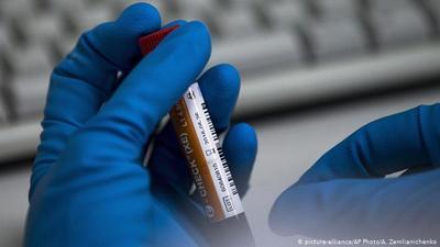 WADA выявило 145 измененных допинг-проб в московской антидопинговой лаборатории