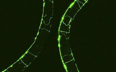Ученым удалось увеличить продолжительность жизни лабораторного червя в шесть раз